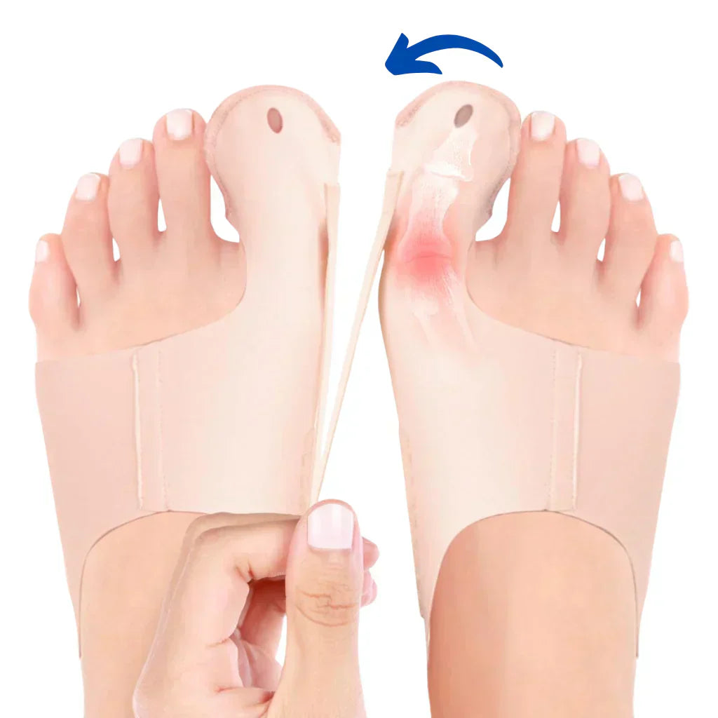 Hallux-Valgus-Bandage zur sanften Zehenkorrektur