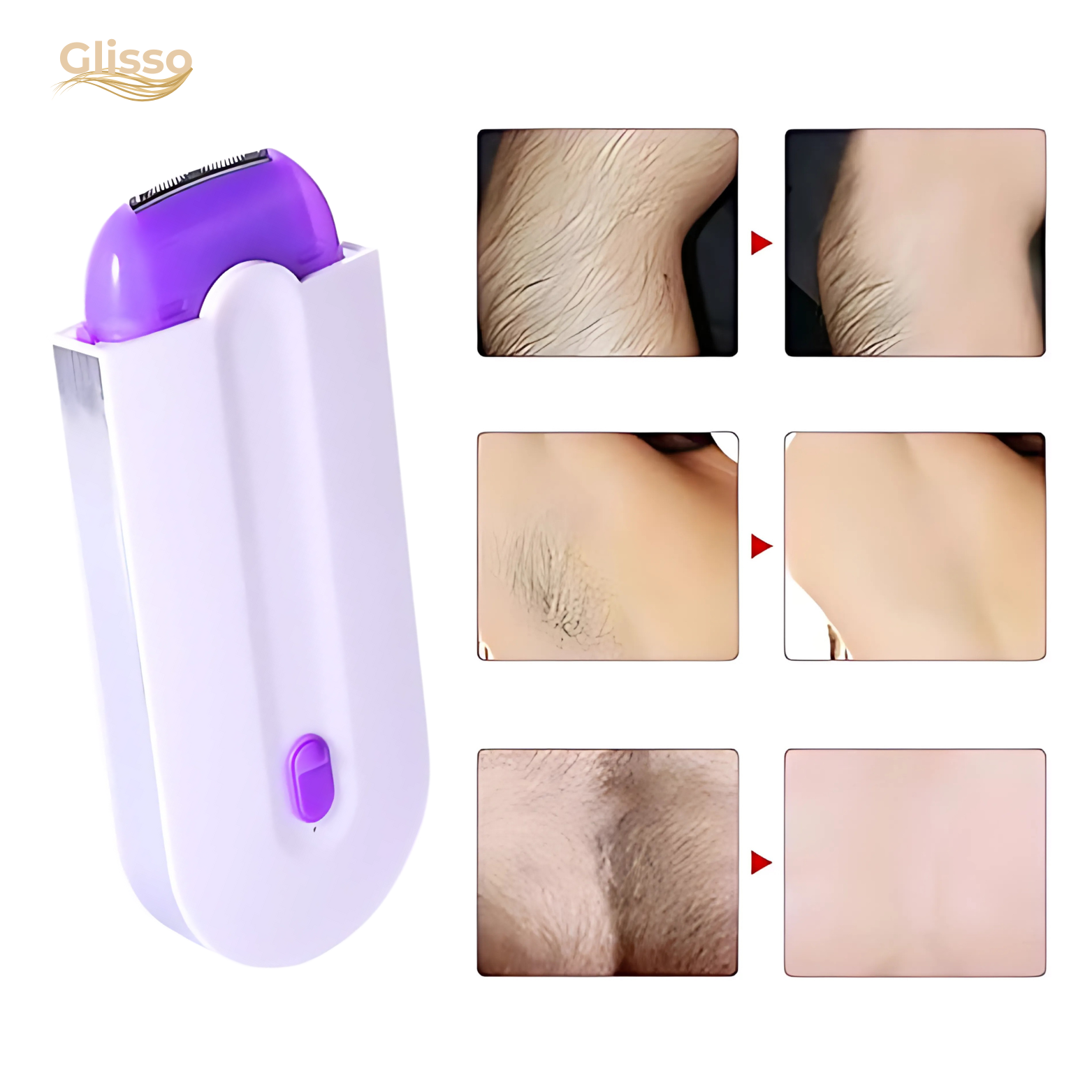 Glisso Hair Remover – Painless Micro-Oscillation