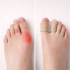 Hallux Valgus Toe Separator with Gel Cushion