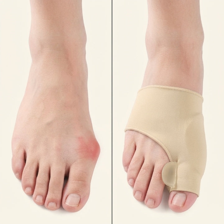 Hallux Valgus Corrector – Immediate Pain Relief with Gel Padding