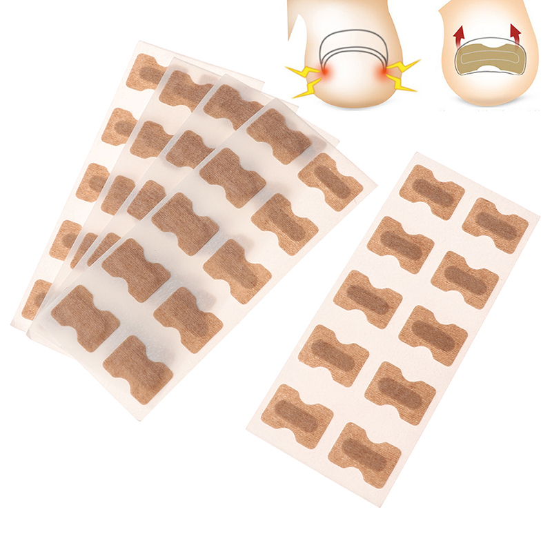 Nail patch for correcting ingrown nails