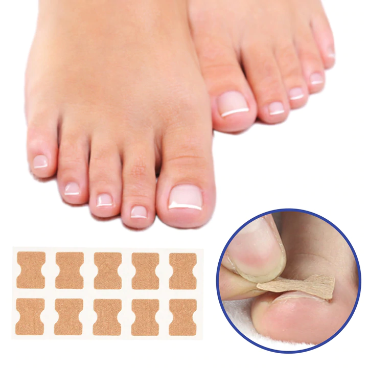Nail patch for correcting ingrown nails