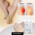 Silicone Toe Separator – Soft Toe Correction