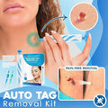 Hautfibrom-Entfernungsset mit Ligaturband