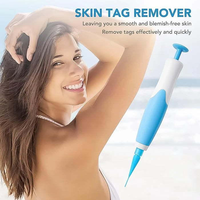 Skin Tag Removal Kit – Painless Micro-Compression Technology