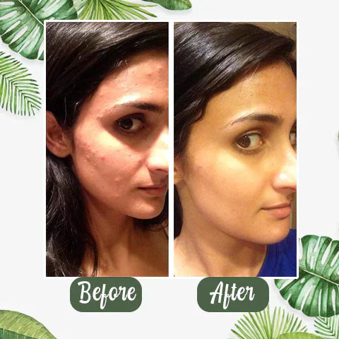 Face mask green tea extract for deep pore cleansing
