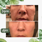 Face mask green tea extract for deep pore cleansing